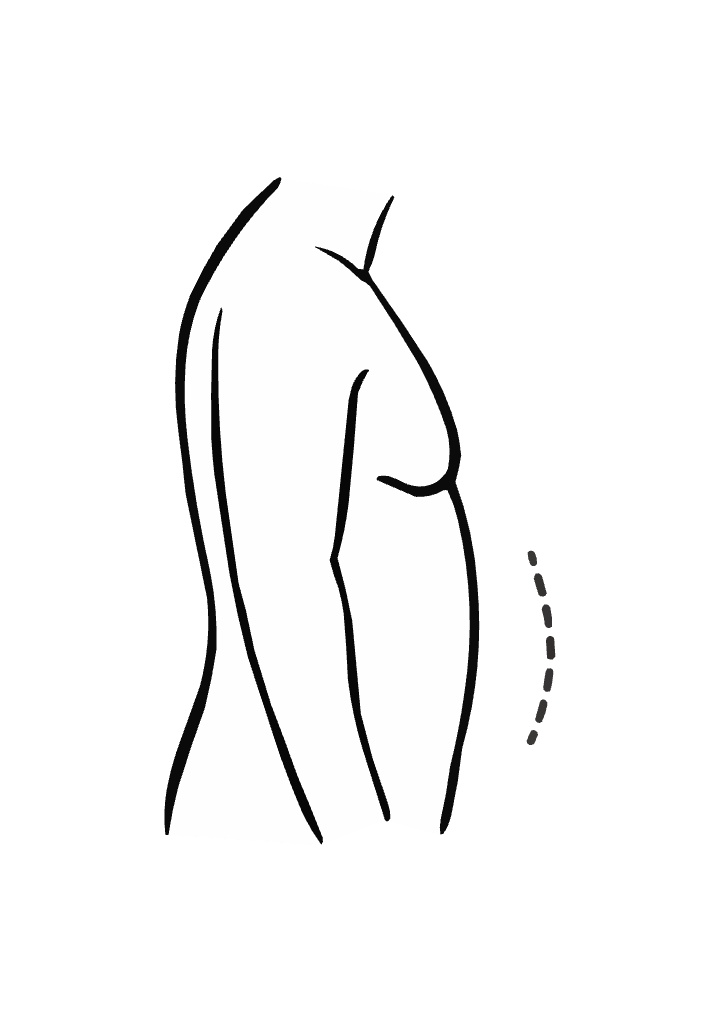 Runde Bauchform
